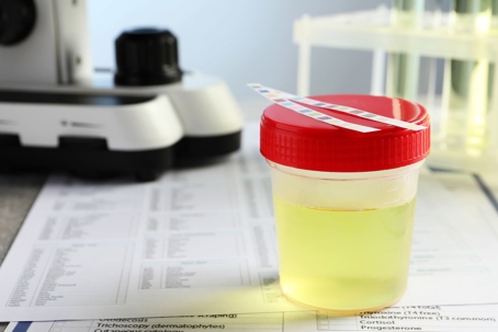 Consequences Of Failing Drug Test During Probation