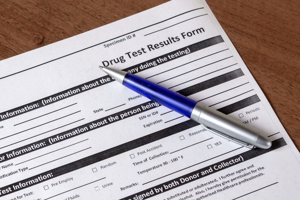 What Happens If You Fail a Drug Test on Probation?
